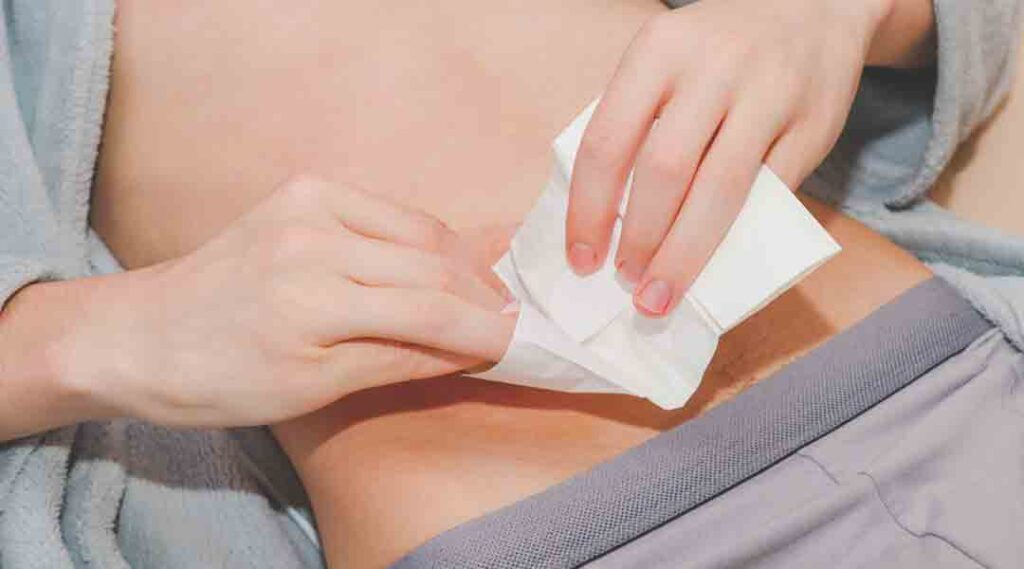 Eine Frau hält ein Taschentuch in ihrer Hand, um Hautirritationen bei Stoma zu behandeln. Stoma Komplikationen